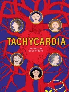 Tachycardie 